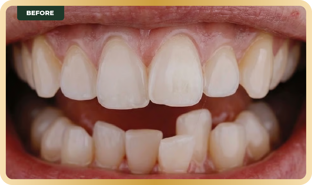 Orthodontic Services 4 Asset
