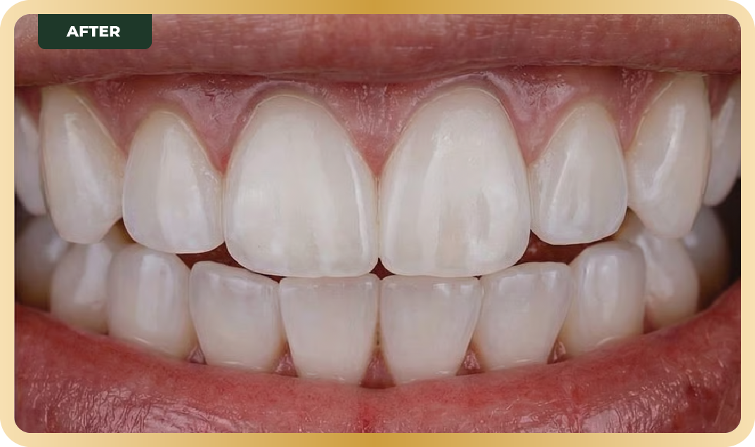 Orthodontic Services 5 Asset 4@2x 1
